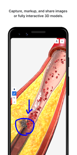 Screen